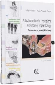 Atlas komplikacija i neuspjeha u dentalnoj implantologiji
