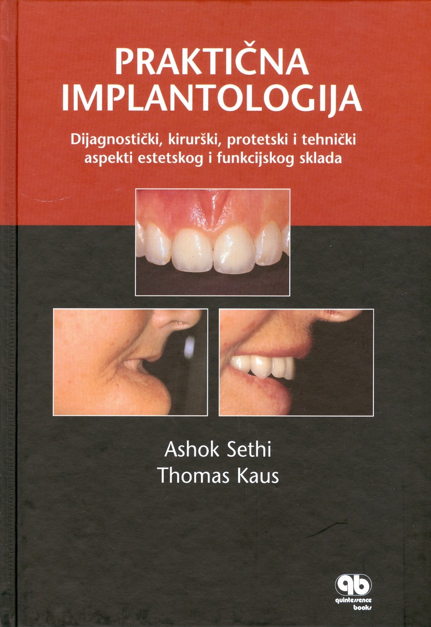 Praktična implantologija, knjiga