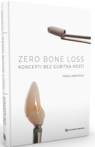 Zero bone loss