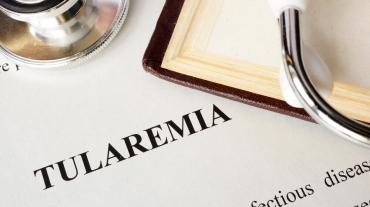 Tularemija