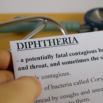 Difterija