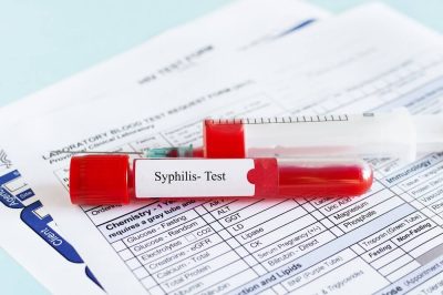 Ostali neoznačeni sifilisi