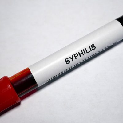 Sifilis van polnih organa