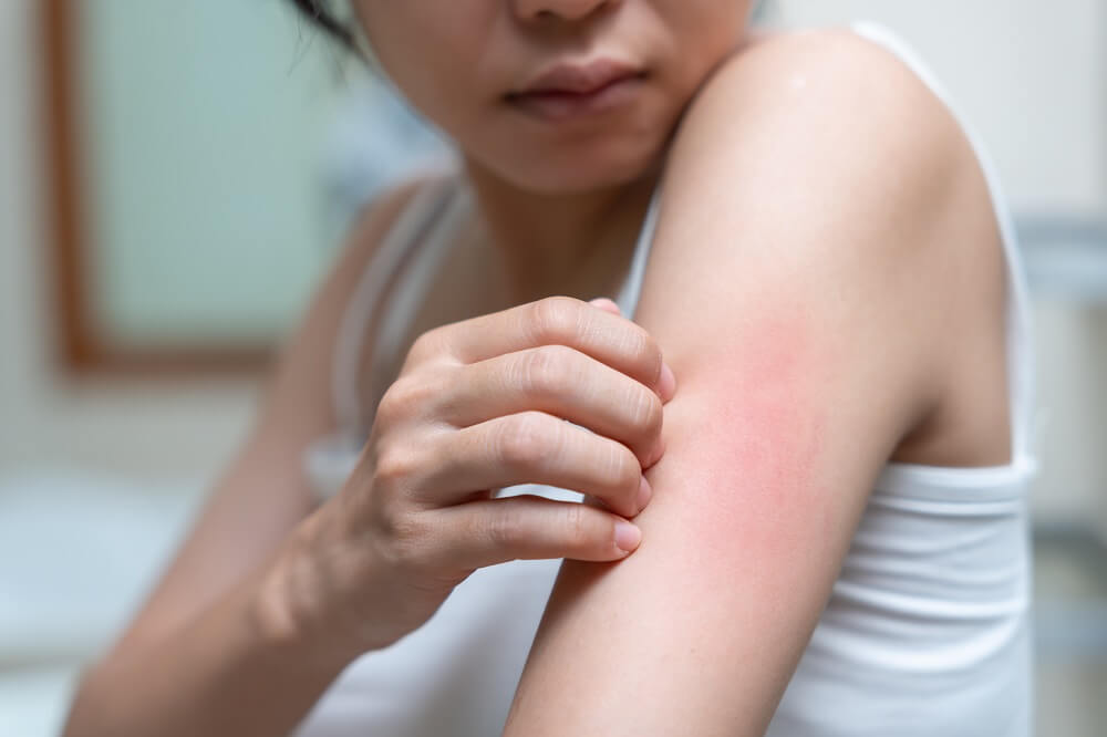Infekcije sa oštećenjem kože