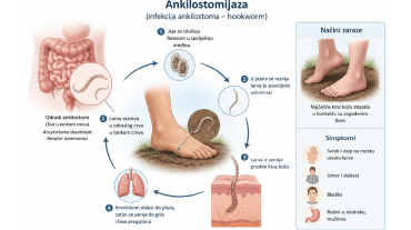 Ankilostomijaza