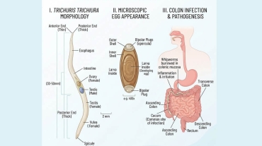 Trichuriasis, ilustracija