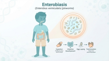 enterobiasis